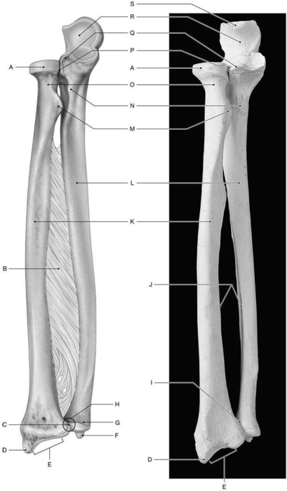Figure 7.5 Using the above-referenced figures of the anterior view of the radius and ulna, identify the specified labeled items in each of the following questions. -Identify the structure indicated by Label Q.