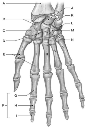 Figure 7.6     Using the above-referenced figure of the anterior (palmar)view of the bones of the right wrist and hand, identify the specified labeled part in each of the following questions. -Identify the structure indicated by Label N.