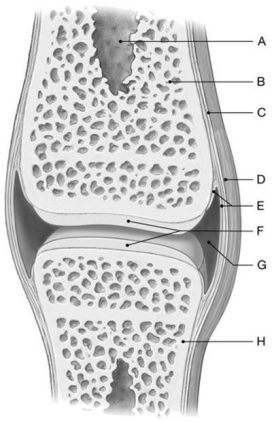 <strong>Figure 8.1 Using the above-referenced diagrammatic view of a simple articulation, identify the specified labeled items in each of the following questions. Identify the structure(s) indicated by Label C.</strong> A) Endosteum B) Synovial membrane C) Joint capsule D) Periosteum E) Articular cartilage