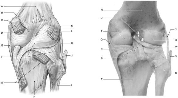 Figure 8.5 Using the above-referenced posterior views of the extended right knee (joint capsule removed in right side cadaveric image), identify the specified labeled items in each of the following questions. -Identify the structure(s) indicated by Label S.
