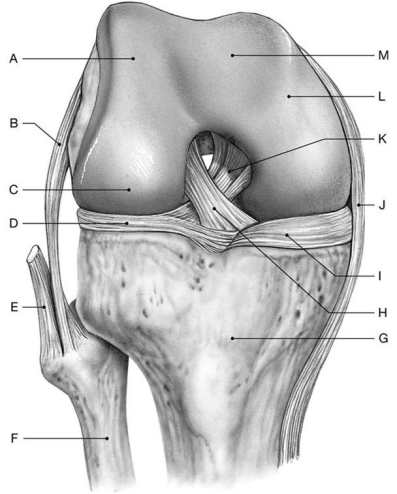 Figure 8.6 Using the above-referenced anterior view of the right knee at full flexion (joint capsule, patella, and associated ligaments removed), identify the specified labeled items in each of the following questions. -Identify the structure(s) indicated by Label H.