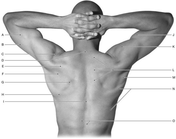 <strong>Figure 12.2 Using the above-referenced figure illustrating the back and shoulder regions of the thorax, identify the specified labeled structure(s) in each of the following questions. Identify the structure(s) indicated by Label F.</strong> A) Infraspinatus muscle B) Teres major muscle C) Trapezius muscle D) Deltoid muscle E) Latissimus dorsi muscle