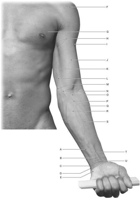 <strong>Figure 12.3 Using the above-referenced anterior view of the left arm, forearm, and wrist, identify the specified labeled structure(s) in each of the following questions. Identify the structure(s) indicated by Label H.</strong> A) Coracobrachialis muscle B) Biceps brachii muscle C) Medial epicondyle D) Triceps brachii muscle E) Cephalic vein