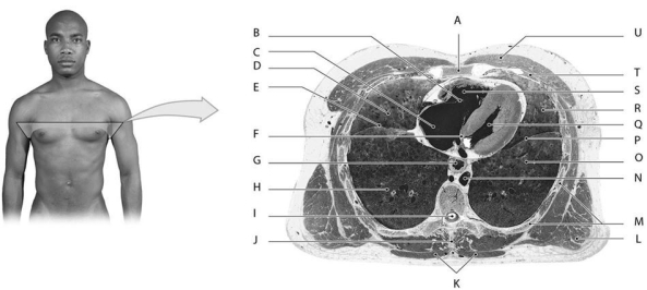 Figure 12.5 Using the above-referenced diagram of a cross section at the level of vertebra T8, identify the specified labeled structure(s) in each of the following questions. -Identify the structure(s) indicated by Label S.