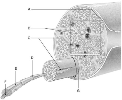 Figure 14.4     Using the above-referenced diagram of a typical peripheral nerve and its connective tissue wrappings, identify the specified labeled structure(s) in each of the following questions. -Identify the structure(s) indicated by Label A.