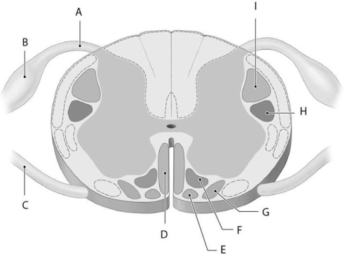 <strong> Using the figure above, identify the labeled structure(s) in each of the following questions. Identify the structure(s) indicated by Label I.</strong> A) Lateral corticospinal tract B) Anterior spinocerebellar tract C) Lateral spinothalamic tract D) Rubrospinal tract E) Anterior corticospinal tract