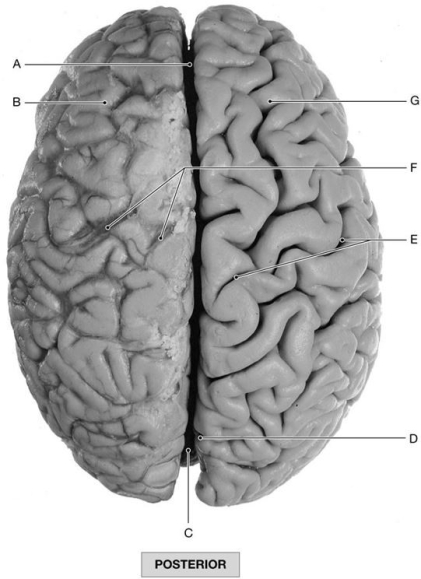 Figure 16.5 Using the figure above, identify the labeled structure(s) in each of the following questions. -Identify the structure indicated by Label A.