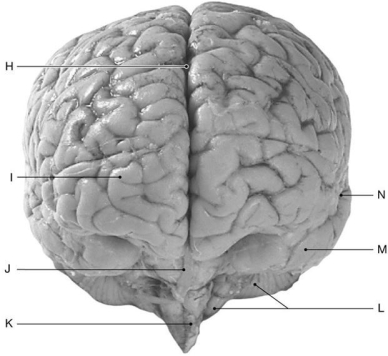 Figure 16.6 Using the figure above, identify the labeled structure(s) in each of the following questions. -Identify the structure indicated by Label J.