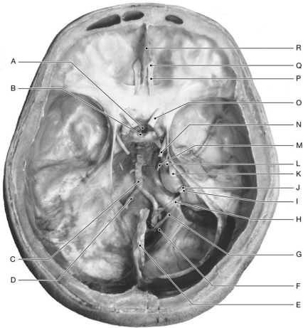 Figure 16.10 Using the figure above, identify the labeled structure(s) in each of the following questions. -Identify the structure indicated by Label E.