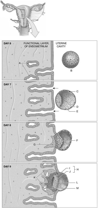 Figure 28.1 Identify the labeled structure(s) in each of the following questions. -Identify the structure indicated by Label F.