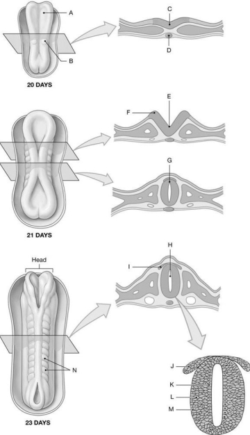 Figure 28.4 Identify the labeled structure(s) in each of the following questions. -Identify the structure indicated by Label A.