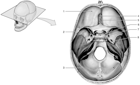 <strong> Figure 7-1 Floor of the Cranial Cavity Use Figure 7-1 to answer the following questions: Which bone structure has foramina for the olfactory nerves?</strong> A)1 B)2 C)3 D)4 E)5