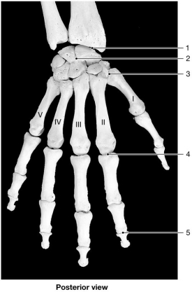 <strong>  Figure 9-2 Bones of the Wrist and Hand Use Figure 9-2 to answer the following questions: Identify the type of joint at label 2.</strong> A)hinge B)condylar C)gliding D)saddle E)pivot <div style=padding-top: 35px> 