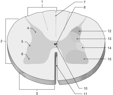 <strong> Figure 13-1 The Spinal Cord Use Figure 13-1 to answer the following questions: Identify the structure labeled 1.</strong> A)anterior white column B)lateral white column C)lateral white horn D)median commissure E)posterior white column