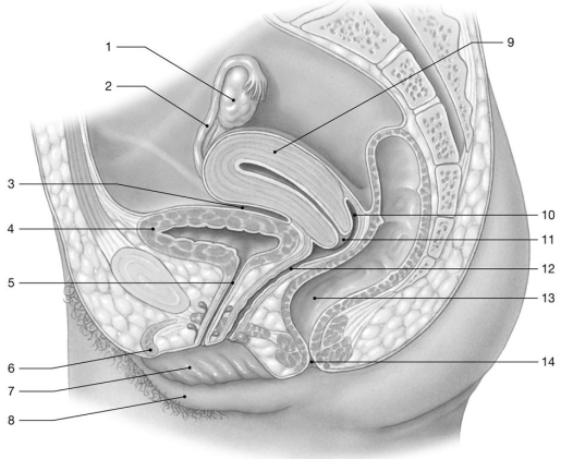 Figure 28-2 The Female Reproductive System Use Figure 28-2 to answer the following questions: -Identify the structure labeled 12.