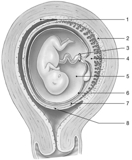Figure 29-2 Fetus at 10 Weeks Use Figure 29-2 to answer the following questions: -Identify the structure labeled 4.