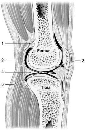 <strong> Figure 9-1 A Simplified Sectional View of the Knee Joint Use Figure 9-1 to answer the following questions: Identify the structure labeled 5.</strong> A) serous membrane B) synovial membrane C) joint capsule D) periosteum E) intracapsular ligament