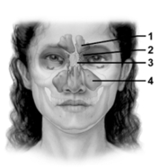 <strong> Which sinus does the number 4 indicate?</strong> A)Frontal sinus B)Maxillary sinus C)Ethmoidal sinus D)Sphenoidal sinus E)Sagittal sinus