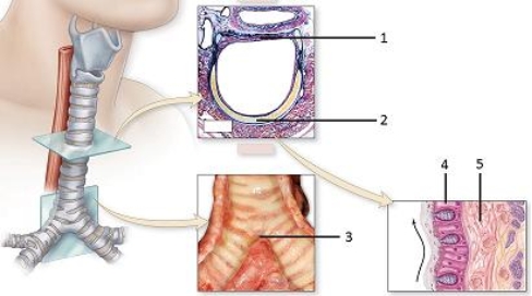 <strong> In these views of the trachea,what type of tissue does number 4 indicate?</strong> A)Keratinized stratified squamous epithelium B)Pseudostratified ciliated columnar epithelium C)Mucous connective tissue D)Ciliated simple columnar epithelium E)Fibrocartilage