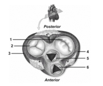 <strong> In this figure showing an oblique section of the heart,the pulmonary semilunar valve is number</strong> A)1. B)2. C)3. D)5. E)6.