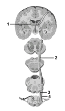 <strong> This figure shows the anterolateral pathway.What structure does number 2 indicate?</strong> A)Tertiary neuron B)Secondary neuron C)Primary neuron D)Primary somatosensory cortex E)Thalamus