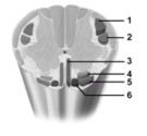 <strong> This figure shows motor pathways.What tract does number 5 indicate?</strong> A)Lateral corticospinal tract B)Rubrospinal tract C)Anterior corticospinal tract D)Vestibulospinal tract E)Tectospinal tract
