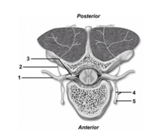 <strong> This figure shows spinal nerve branches.What structure does number 1 indicate?</strong> A)Anterior ramus B)Posterior ramus C)Rami communicantes D)Sympathetic trunk ganglion E)Posterior root ganglion
