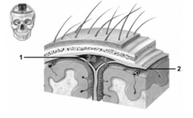 -This figure shows the cranial meninges.What structure does number 1 indicate?