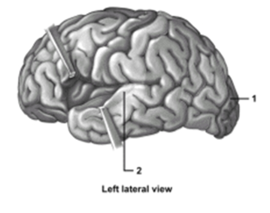 -This figure shows the lobes of the cerebrum.What structure does number 1 indicate?