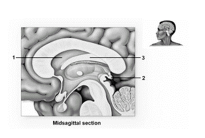 -This figure shows the diencephalon.What structure does number 1 indicate?