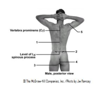 <strong> This figure shows a posterior view of the male.Which structure does number 3 indicate?</strong> A)Natal cleft B)Olecranon C)Erector spinae D)Triangle of auscultation E)Gluteal fold