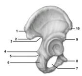 <strong> This figure shows the os coxae.Which of these statements about the figure is correct?</strong> A)The figure shows a right bone,and number 1 indicates the anterior superior iliac spine. B)The figure shows a left bone,and number 6 indicates the ischial tuberosity. C)The figure shows a left bone and number 7 indicates the obturator foramen. D)The figure shows a right bone,and number 3 indicates the greater sciatic notch. E)The figure shows a right bone,and number 8 indicates the ischial spine.