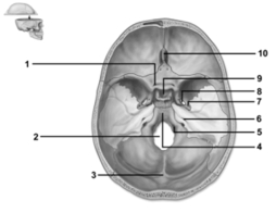 <strong> This figure shows a superior view of the cranial cavity.Which number indicates the sella turcica?</strong> A)1 B)3 C)4 D)9 E)10