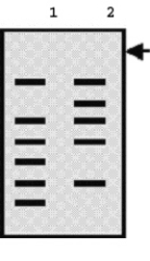 Lane 1 in the following Southern blot contains a sample from a normal control, and lane 2 contains a sample from a patient.The arrow indicates the location of the wells in the agarose gel used in this analysis.The probe used was a complementary DNA (cDNA).Which type of mutation is most likely, on the basis of these data?