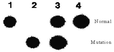 In the following dot blot, the probe used in the upper row is for the normal sequence while the probe in the second row is for the -Phe mutation of the cystic fibrosis gene.What are the genotypes of the four people investigated?