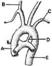 <strong> ________ Derived from the truncus arteriosus</strong> A)A B)B C)C D)D E)E