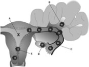 <strong> ________ Most common site of an ectopic pregnancy</strong> A)A B)B C)C D)D E)E