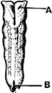 <strong> ________ Hyoid arch</strong> A)A B)B C)C D)D E)E