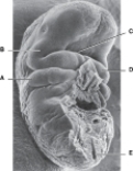 <strong> ______ Defect in its formation results in a severe type of spina bifida</strong> A)A B)B C)C D)D E)E
