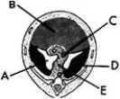 <strong> ________ Gives rise to the central tendon of the diaphragm</strong> A)A B)B C)C D)D E)E