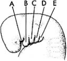 <strong>  ________ Its cartilage forms a greater horn of the hyoid bone</strong> A)A B)B C)C D)D E)E <div style=padding-top: 35px> 