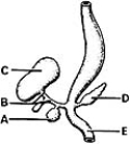 <strong> ________ Primarily involved in extrahepatic biliary atresia</strong> A)A B)B C)C D)D E)E