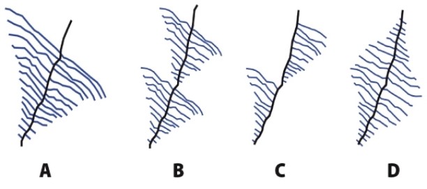 <strong>Which of the diagrams below shows what one would see in the electron microscope during the transcription of a polycistronic bacterial operon that codes for two proteins? </strong> A)A B)B C)C D)D