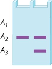 <strong>A restriction-fragment length polymorphism at a site in the X chromosome has three alleles, A<sub>1</sub>, A<sub>2</sub>, and A<sub>3</sub>. The gel below is the DNA fingerprint for two girls who have the same parents. What is the genotype of the mother? Of the father? </strong> A)A<sub>1</sub>/A<sub>2</sub>; A<sub>3</sub> B)A<sub>1</sub>/A<sub>3</sub>; A<sub>2</sub> C)A<sub>2</sub>/A<sub>3</sub>; A<sub>1</sub> D)A<sub>2</sub>/A<sub>3</sub>; A<sub>2</sub> E)A<sub>2</sub>/A<sub>3</sub>; A<sub>3</sub>