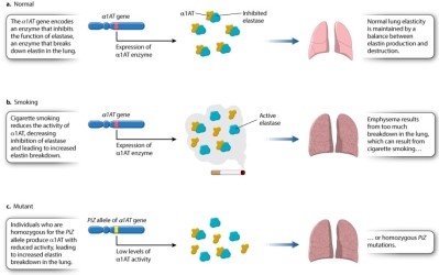 <strong>Which statement about the PiZ allele is NOT true? Consult Figure 15.2 below. </strong> A)The PiZ allele is common in populations of European descent. B)The product of nonmutant alleles of the gene inhibits elastase in the lungs. C)Individuals homozygous for the PiZ allele have normal lung elasticity. D)Normal lung elasticity depends on elastase inhibition. E)Smokers who are homozygous for the PiZ allele have a shortened life expectancy.