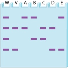 <strong>A weapon (W) left behind at a crime scene is typed for a variable number tandem repeat (VNTR). The DNA from the weapon includes bands from the victim (V) as well as those from the perpetrator. Which of the suspects A-E has VNTR bands that are consistent with those of the perpetrator?</strong> A)suspect A B)suspect B C)suspect C D)suspect D E)suspect E
