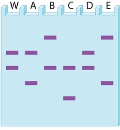 <strong>The gel diagram below shows the bands obtained for a single variable number tandem repeat (VNTR) in evidence obtained at a crime scene (W) and genomic DNA from four suspects (A-E). Which suspect CANNOT be ruled out as the source of the DNA in the sample?</strong> A)suspect A B)suspect B C)suspect C D)suspect D E)suspect E