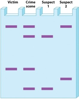 <strong>The figure below represents analysis of blood from a victim of a crime and from two suspects. Criminologists created this gel using restriction fragments from a variable number tandem repeat (VNTR) site. Which suspect is definitely innocent?</strong> A)suspect 1 B)suspect 2 C)Both suspects are definitely innocent. D)Neither suspect is definitely innocent.