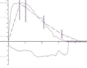 <strong>Which interpretation is consistent with the following flow-volume curve?  </strong> A) Normal flow-volume loop B) Variable intrathoracic obstruction C) Variable extrathoracic obstruction D) Fixed large airway obstruction <div style=padding-top: 35px> 