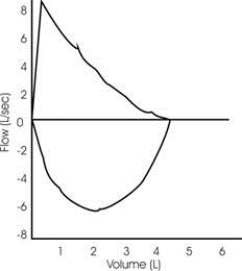 <strong>Which of the following diagnoses is consistent with the following flow-volume curve? </strong> A) Variable intrathoracic obstruction B) Fixed extrathoracic obstruction C) Small airway obstruction D) Normal expiratory and inspiratory flows